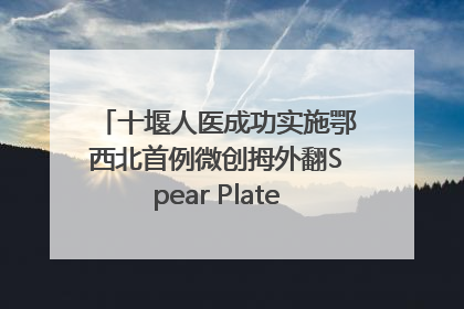 十堰人医成功实施鄂西北首例微创拇外翻Spear Plate髓内板矫形术